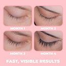 Flovura Flovura™ Eyelash Growth Enhancer & Brow Serum with Biotin & Natural Growth Peptides OODS0000424