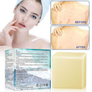 Theoup Sea Salt Bar Soap Treatment Against Acne and Other Skin Problems 100g